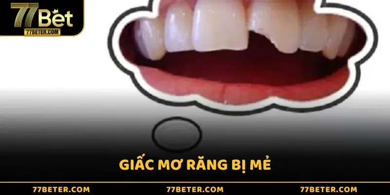 Giấc mơ răng bị mẻ